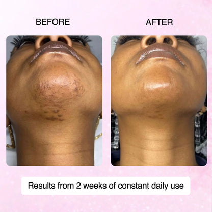 Cyperus Rotundus Skin Serum